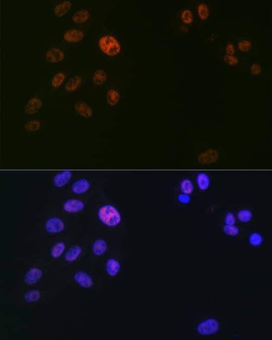 SUPT5H Antibody (9V9G7)