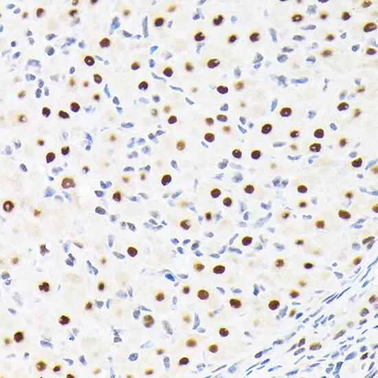 SUPT5H Antibody (9V9G7)