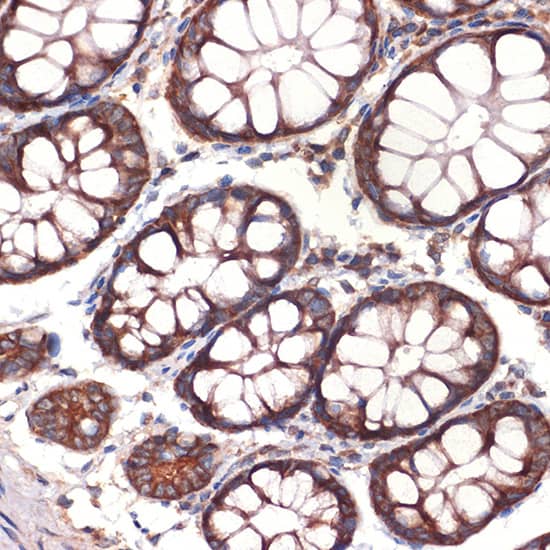 CC2D1A Antibody (5Y6S6)