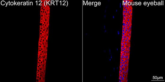 Cytokeratin 12 Antibody (2M1K10)