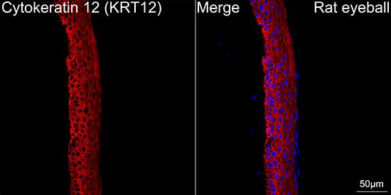 Cytokeratin 12 Antibody (2M1K10)