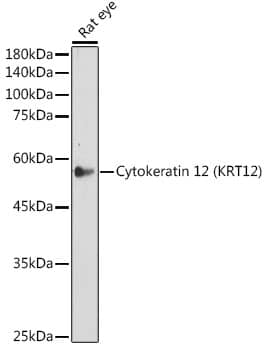 Cytokeratin 12 Antibody (2M1K10)