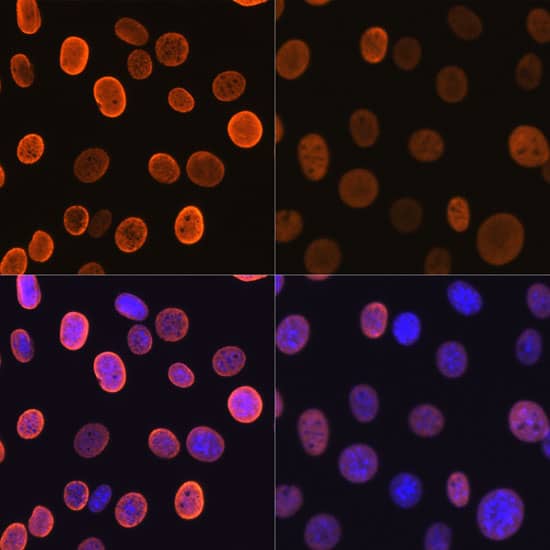 Histone H4 [ac Lys5] Antibody (10G1L0)