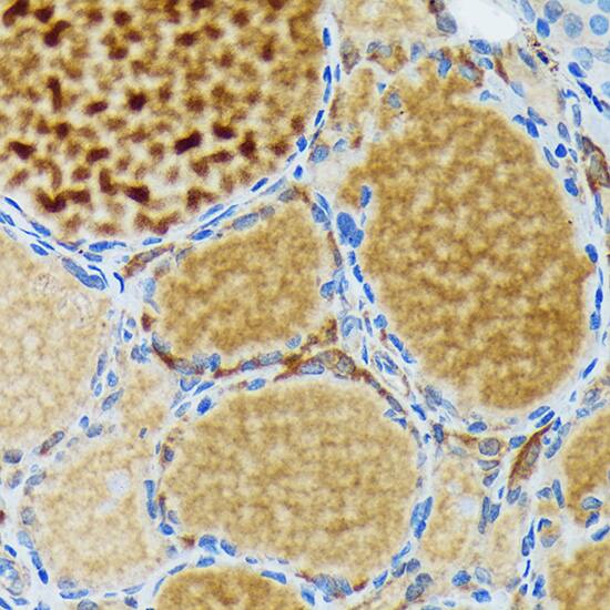 Thyroid Peroxidase Antibody (3C4A4)