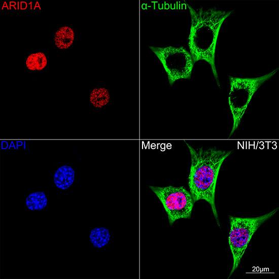 ARID1A Antibody (9D4J6)