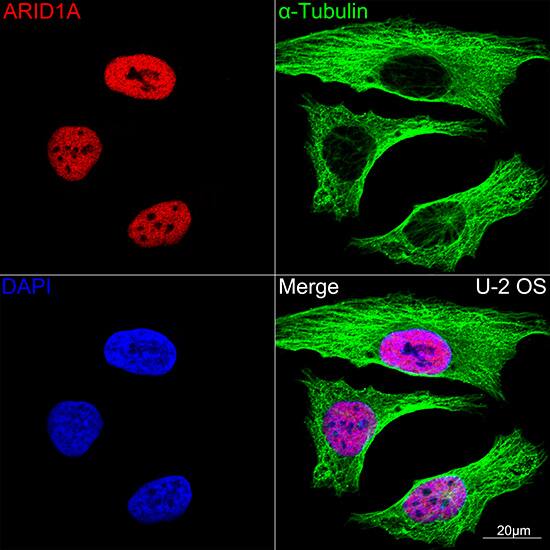 ARID1A Antibody (9D4J6)