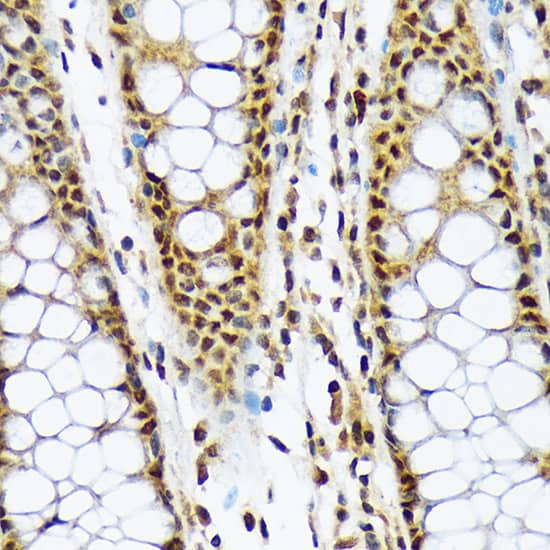 MAD2L1-binding protein Antibody (7W8H1)