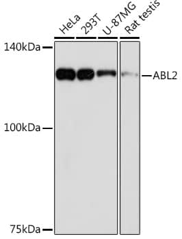 ABL2 Antibody (2L9C6)