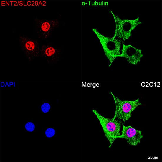 ENT2 Antibody (7B2J3)