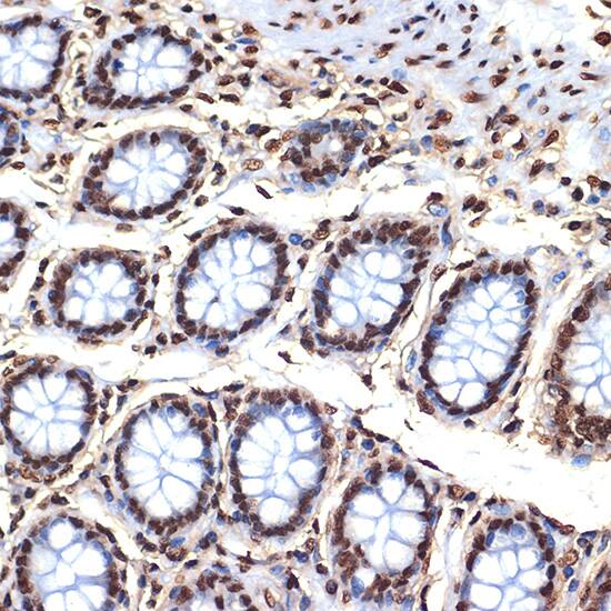 Histone H4 Antibody (4R4N3)