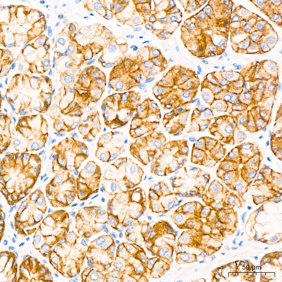 Claudin-18.2 Antibody (3J4G7)