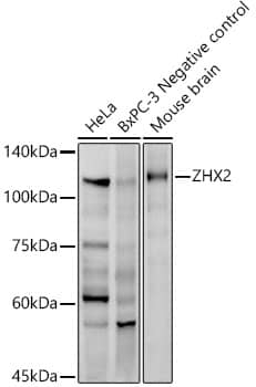 ZHX2 Antibody (8N7O2)