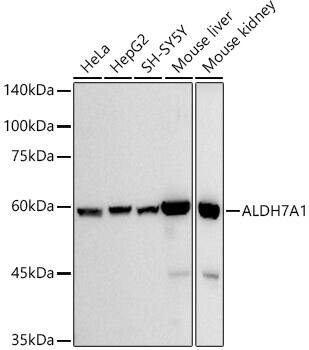 ALDH7A1 Antibody (3I6B6)