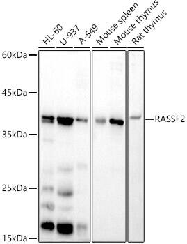 RASSF2 Antibody (5U1E0)