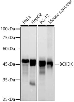 BCKDK Antibody (5J3L3)