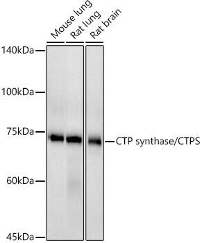 CTP synthase Antibody (9T4J2)