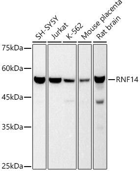 ARA54 Antibody (4X10Q6)