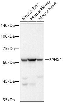 EPHX2 Antibody (8E2X2)