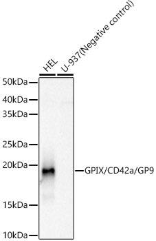 GP-IX Antibody (9C6U5)