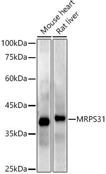 MRPS31 Antibody (3J3T5)