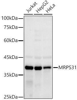 MRPS31 Antibody (3J3T5)