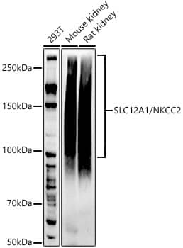 NKCC2/SLC12A1 Antibody (9I0U8)