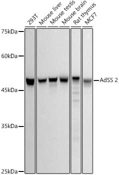 Adenylosuccinate Synthase Antibody (1P8D9)