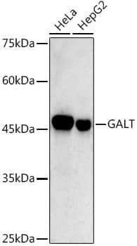 GALT Antibody (2R0A8)