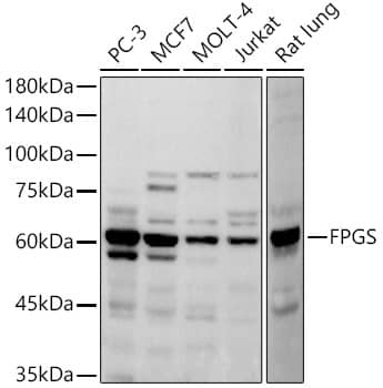 FPGS Antibody (7E2H1)