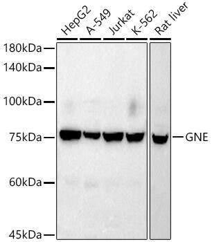 N-Acetylmannosamine Kinase/GNE Antibody (5T9K10)