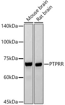 PCPTP1 Antibody (5R6L5)