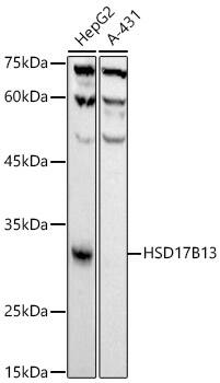 HSD17B13 Antibody (10T10L5)