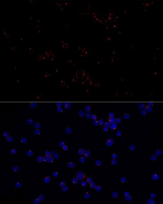 FGFR1OP Antibody (2T2F9)