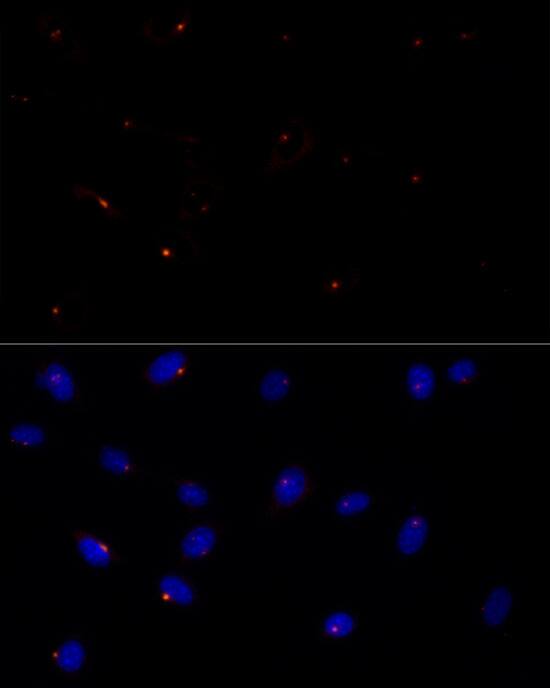 FGFR1OP Antibody (2T2F9)