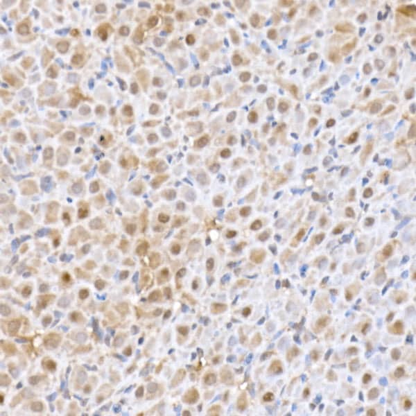 UbcH5a/UBE2D1 Antibody (8E6O0)