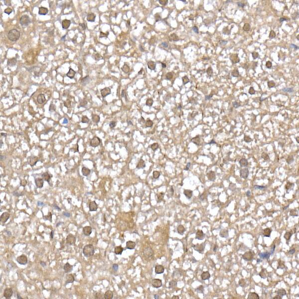 UbcH5a/UBE2D1 Antibody (8E6O0)