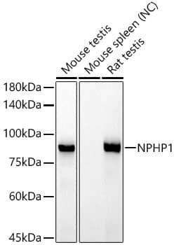 Nephronophthisis Antibody (6T10Z4)