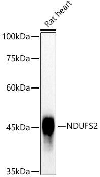 NDUFS2 Antibody (9W2N4)