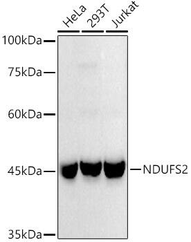 NDUFS2 Antibody (9W2N4)