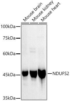 NDUFS2 Antibody (9W2N4)