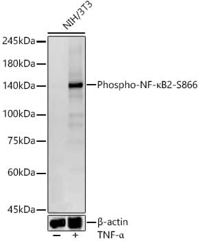 NFkB2/NFkB p100 [p Ser866] Antibody (1J7E2)