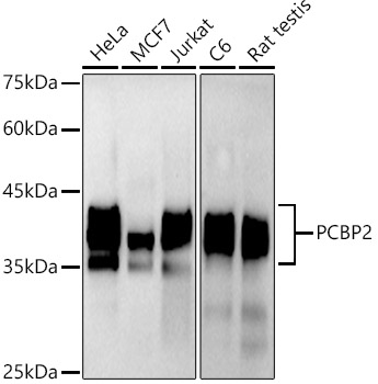 PCBP2 Antibody (4K6I6)