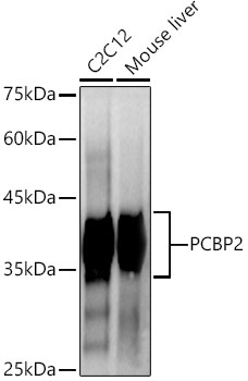 PCBP2 Antibody (4K6I6)