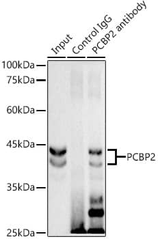 PCBP2 Antibody (4K6I6)