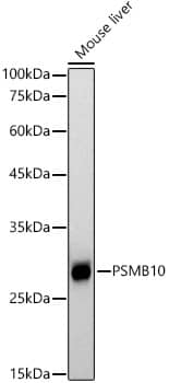 PSMB10/MECL1 Antibody (3J3G5)