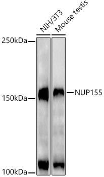 NUP155 Antibody (9I10M5)