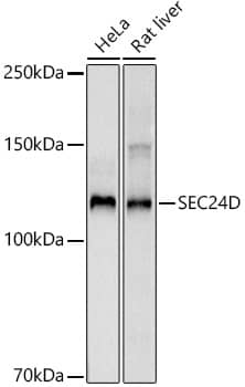 SEC24D Antibody (6F8S4)