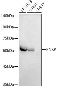 PNK Antibody (7J6Y6)