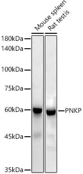 PNK Antibody (7J6Y6)