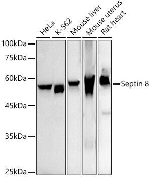 Septin-8 Antibody (5A2J9)